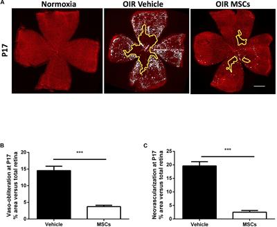 Mesenchymal Stromal Cells Promote Retinal Vascular Repair by Modulating Sema3E and IL-17A in a Model of Ischemic Retinopathy